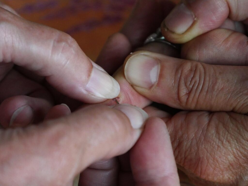 first aid for dog bee stings in the garden